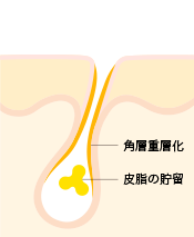 つまらない博士の つまらないお話 Ipsa 公式サイト