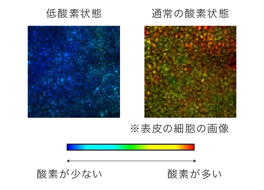 低酸素状態と通常の酸素状態の表皮の細胞の画像